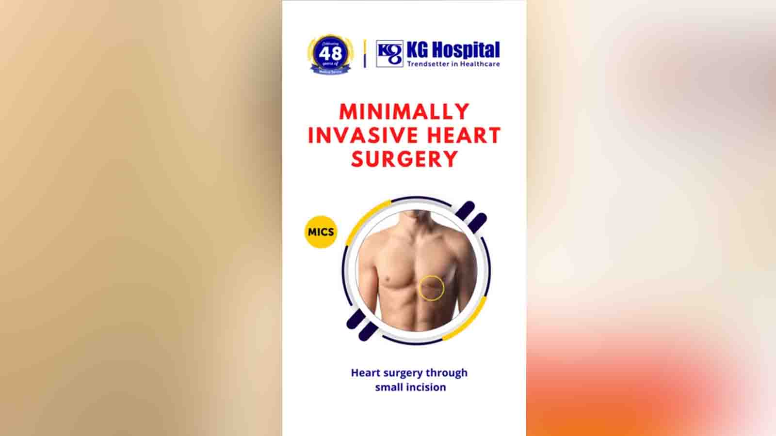 Minimally Invasive Heart Surgery - KG Hospital Coimbatore